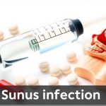 Steroid Shot for Sinus Infection